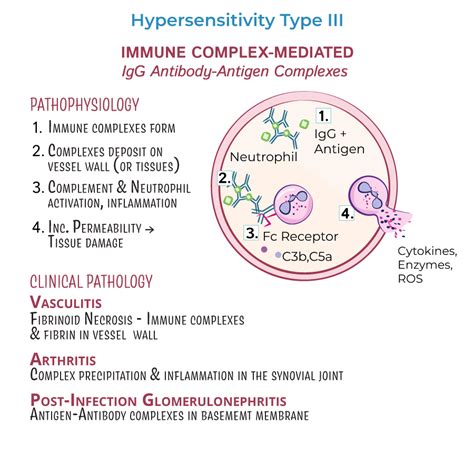 Clinical Pathology Glossary Hypersensitivity Type Iii Ditki Medical