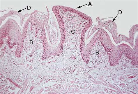 Section Of A Fungiform Papilla