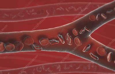 Blood on the dance floor. Capillary blood vessels - Stock Image - F002/3881 ...