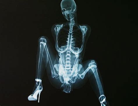 Weird Things Blog Archive X Rated X Rays