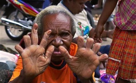 奇葩！印尼部落习俗：家族有人去世妇女须砍掉一节手指 凤凰网