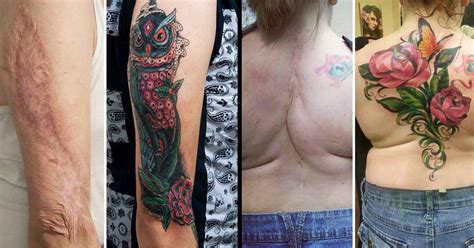 Cover Up Open Heart Surgery Scar Tattoo