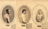 Photos of Wounded Civil War Soldiers Used to Determine How Much Post ...