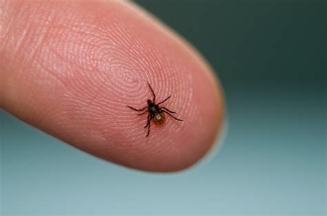 Uk Warning After Extremely Rare Tick Bite Infection That Can Cause