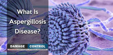 What Is Aspergillosis Disease Damage Control