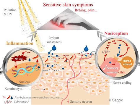 Biological Mechanisms Underlying Sensitive Skin Ständer Et Al 2009