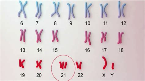 Qu Son Las Dotaciones De Cromosomas Sexuales Alteradas Lib Answers