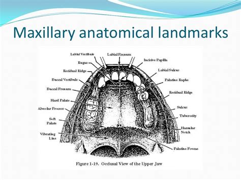 Anatomical Landmarks For Complete Dentures