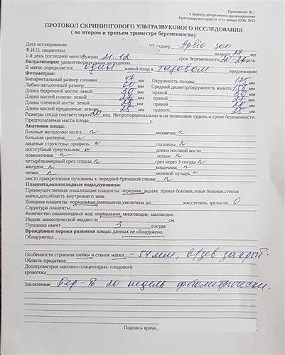 Как похудеть при беременности во 2 триместре
