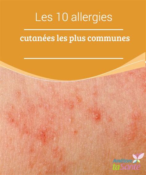 Les 10 Allergies Cutanées Les Plus Communes Améliore Ta Santé Soins