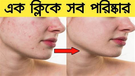 How To Remove Dark Spots From Face In Photoshop । মুখের কালো দাগ খুব