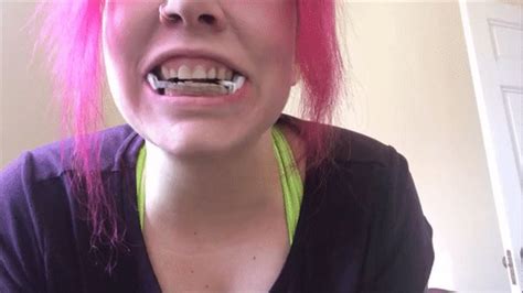Mouthguard And Wanting Braces Candid Talk Wmv Deannas Clip Store