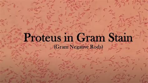 Proteus In Gram Staining YouTube
