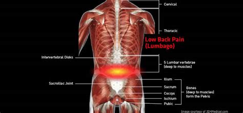 Management of Low Back Pain - Beacon Pharmaceuticals Limited