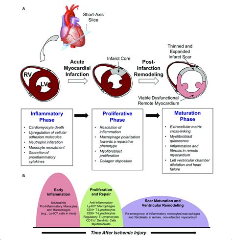 Cardiac Repair After Myocardial Infarction A The Three Phases Of Hot