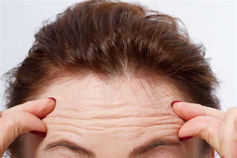 Organic Beauty Report How To Get Rid Of Forehead Wrinkles