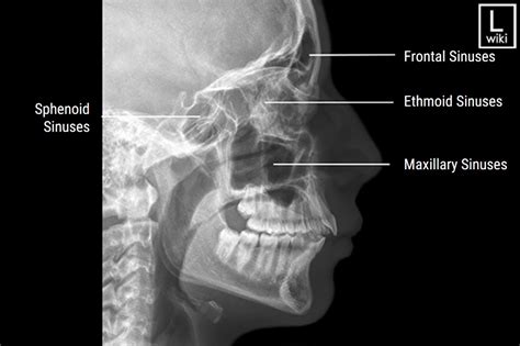 Sinus X Ray Positioning An X Ray Guide Medical Professionals