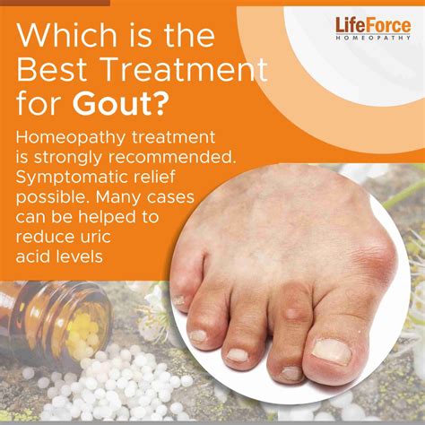 Gout Treatment With Homeopathy Everything You Need To Know