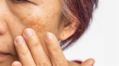 Skin Care Tips Dr Davin Lim