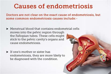 Endometriosis Diagnosis And Management Nice
