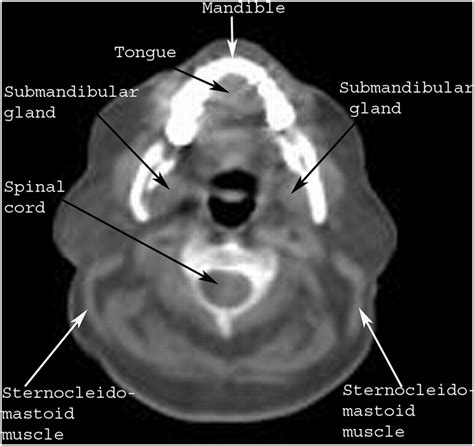 Evaluation And Localization Of Lymphatic Drainage And Sentinel Lymph