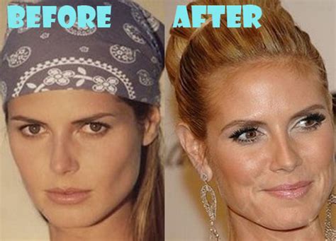 Heidi Klum Plastic Surgery Before And After Pictures Lovely Surgery