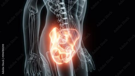 D Rendering Of A Medical Animation Of The Pelvis X Ray Of The Human