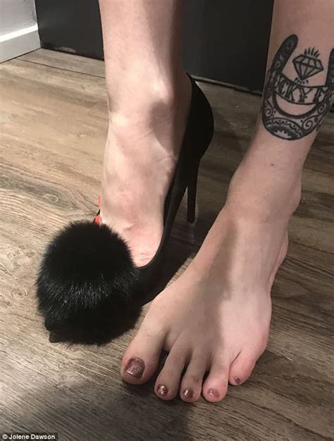 Trans Gold Coast Woman Binds Feet To Make Them Smaller Daily Mail Online
