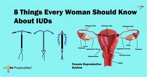 Things Every Woman Should Know About IUDs