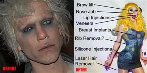 Sharon Needles Plastic Surgery Before And After