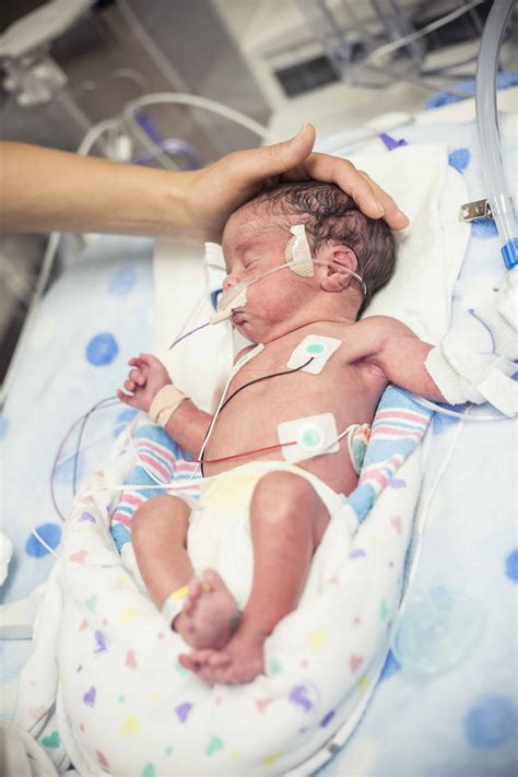 Premature Babies Beyond Preemie Nicu Neonatal Preemie My Xxx Hot Girl