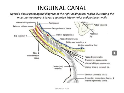 The inguinal canal is a passage in the inferior anterior abdominal wall which gives passage to the spermatic cord (male) or round. Hernia Remediation Coaching Letter: Session #3 ...