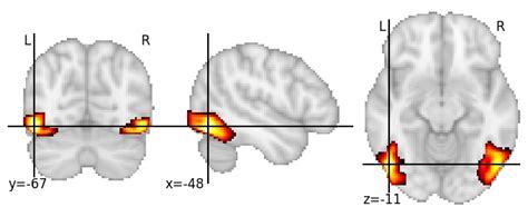 Difumo Dictionary Of Functional Modes For Brain Imaging