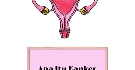 Apa yang menyebabkan hepatitis a? Apa Itu Kanker Serviks? | Dunia Wanita