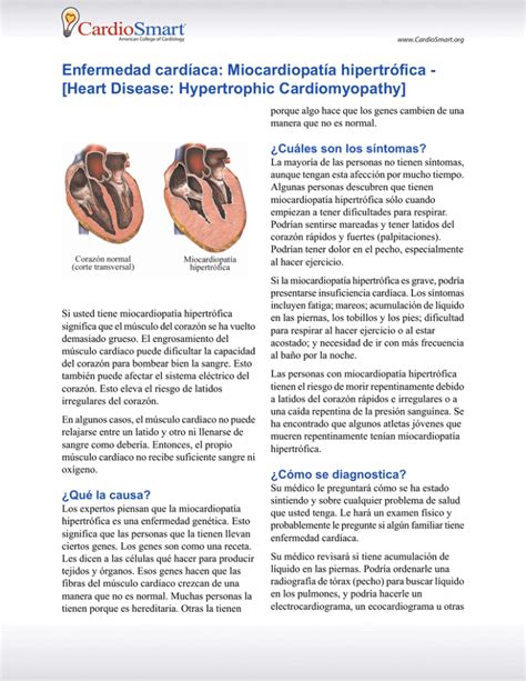 Enfermedad cardíaca Miocardiopatía hipertrófica