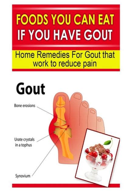 Foods You Can Eat If You Have Gout Home Remedies For Gout That Work To