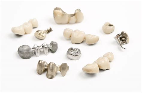 Couronnes dentaires céramiques sans métal pose type sur pivot