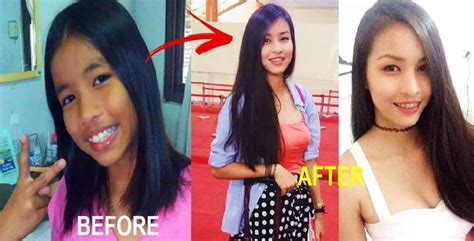 Pinay Stuns Netizens With Her Photos Before And After Puberty Kamicomph