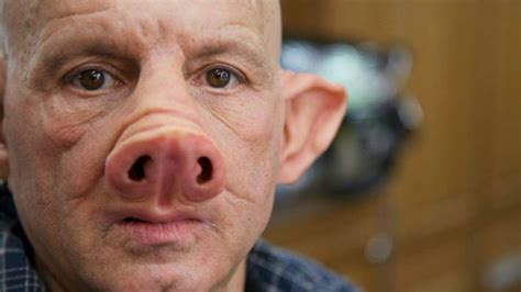 Scientists Create Pig Human Hybrid Chimera Explained Youtube