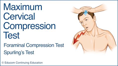 Maximum Cervical Compression Test Spurlings Test Youtube