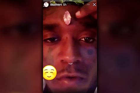 Lil Uzi Vert Shows Off 24m Diamond Forehead Implant Izzso News