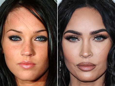 megan fox before and after plastic surgery the skincare secrets ostomy lifestyle