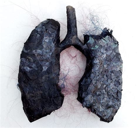 Black Anatomy Lungs In Memory Of My Father Interalia Magazine