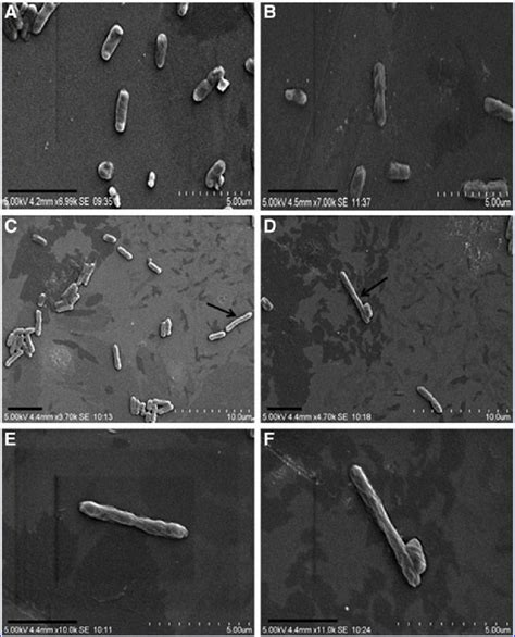 Scanning Electron Microscope Images Of Salmonella Typhimurium Atcc