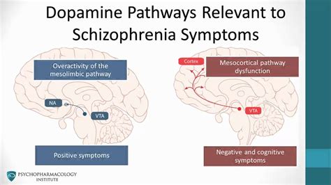 Avolition and occam's razor / g. Antipsychotics & The Dopamine Hypothesis Schizophrenia ...