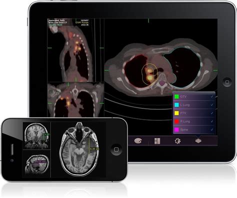 Medical Apps To Assist With Diagnoses Cleared By Fda The New York