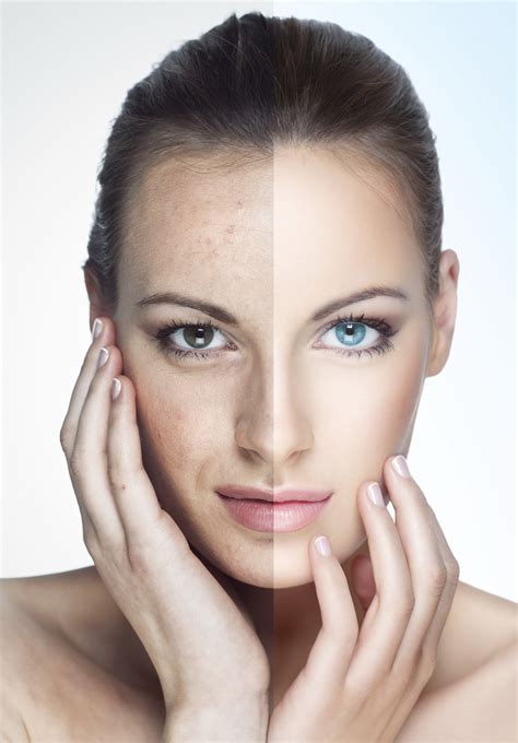 Skincare Treatments - Essex Laser Clinic