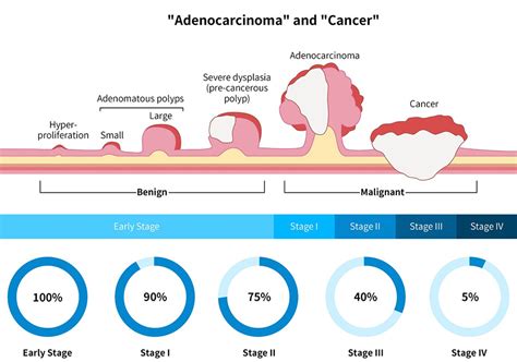 As Colorectal Cancer For The Under S Rises Regular Screening Is
