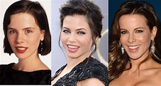 Kate Beckinsale Plastic Surgery Before and After Pictures 2018