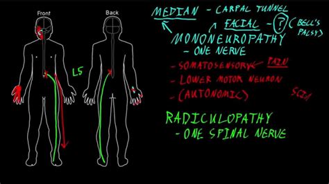 Mononeuropathy And Radiculopathy Youtube